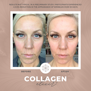 Collagen20BA201