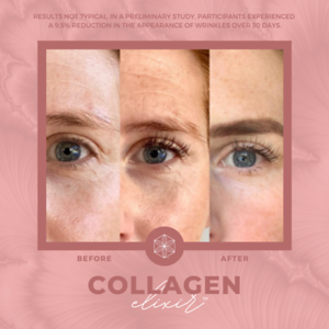 Collagen20BA2010
