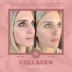 Collagen20BA2011