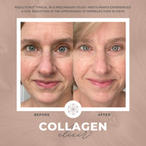 Collagen20BA2012