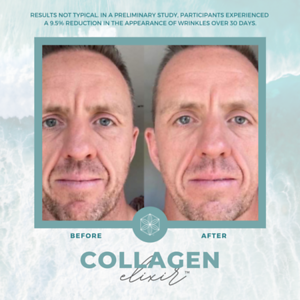 Collagen20BA2013
