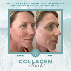 Collagen20BA2014