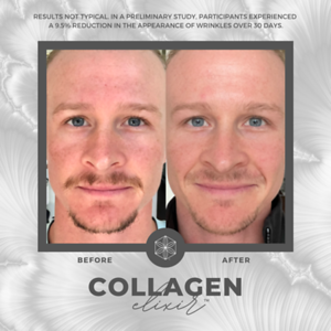 Collagen20BA2015