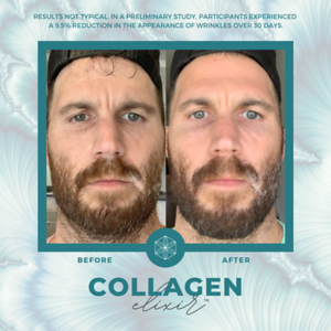 Collagen20BA2016