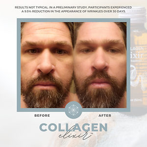 Collagen20BA203