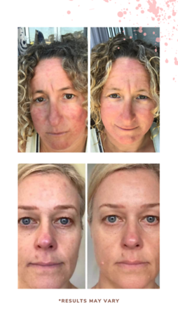 Collagen20BA204
