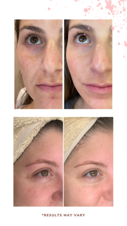 Collagen20BA205
