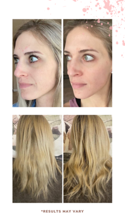Collagen20BA206