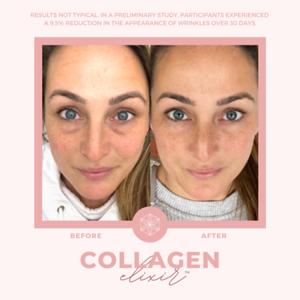 Collagen20BA207