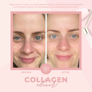 Collagen20BA208