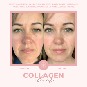 Collagen20BA2082