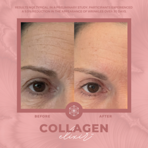 Collagen20BA209