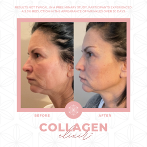 Collagen20BA2092